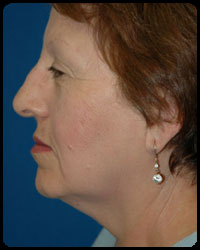 Face and Neck Surgery 